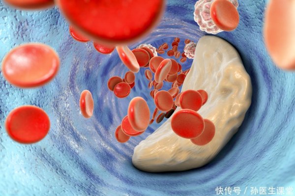 同花财富 医生发现：只需改变下早餐，不仅胆固醇下降了，各个指标都稳定了